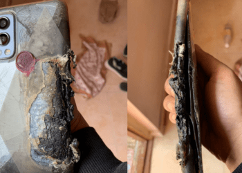 OnePlus Nord 2 User Gets Refund, Medical Expenses After Explosion